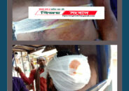 বাকেরগঞ্জে দুধাল ইউনিয়নে তুচ্ছ ঘটনাকে কেন্দ্র করে দুজনকে কুপিয়ে জখম