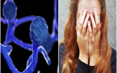 নতুন আতঙ্ক ফাঙ্গাস: লক্ষণ জেনে নিন